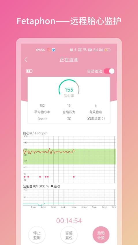 Fetaphon Home手机版